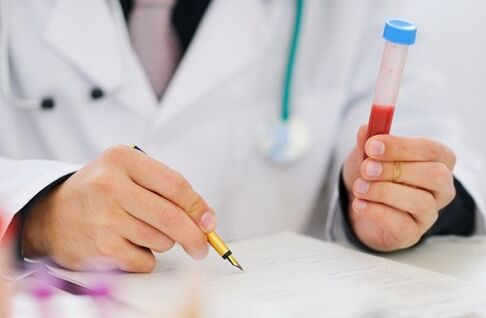 Prostatitis Test for Prescription Drugs